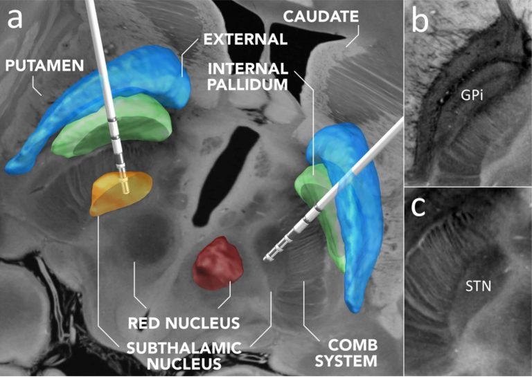 A brain scan illustrating human neuroscience research